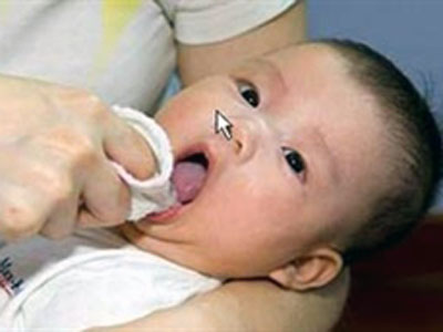 Nuôi con bằng sữa mẹ - trẻ bị tưa lưỡi