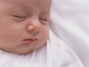 Dấu hiệu nhận biết bé yêu bị tắc tuyến lệ