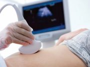 Những câu hỏi thường gặp khi siêu âm thai