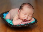 Cách chữa méo đầu ở trẻ sơ sinh