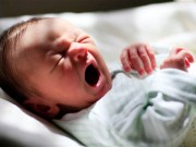 Dị tật thai nhi: Nguyên nhân và cách phòng ngừa