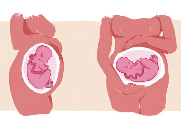 Ngôi thai: Yếu tố quyết định việc sinh nở