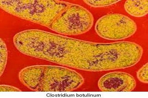 Ngộ độc Clostridium botulinum