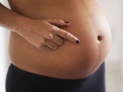 Vạch đen giữa bụng bầu từ đâu mà có?