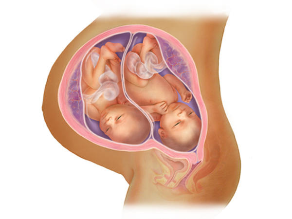 hình ảnh siêu âm thai đôi