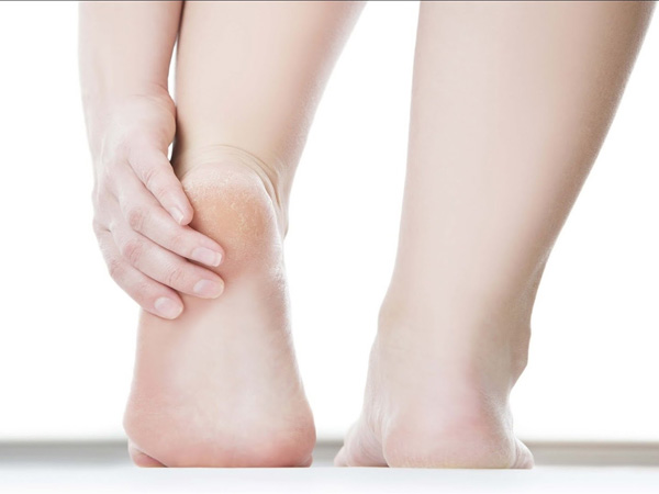 Cách chữa nứt gót chân cho mẹ bầu và mẹ sau sinh