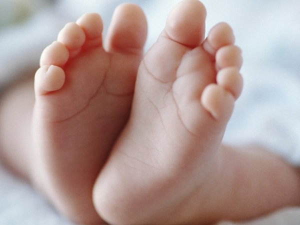 Hội chứng bàn chân bẹt ở trẻ em và những điều mẹ cần biết