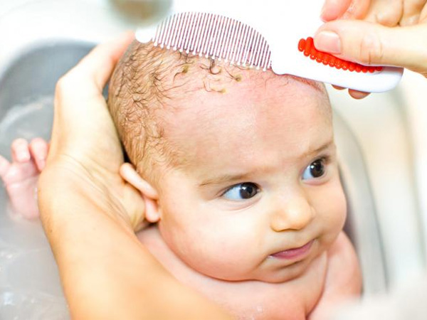 Cứt trâu ở trẻ sơ sinh: 5 mẹo trị cứt trâu cho trẻ đơn giản và hiệu quả