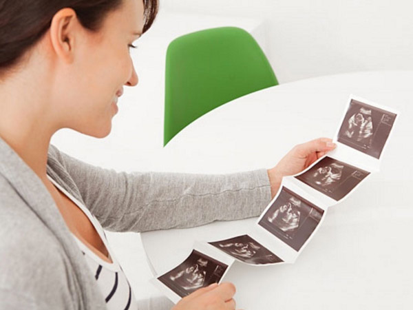 Hội chứng Down ở thai nhi và những sự thật mẹ nên biết