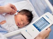 Đừng tiếc tiền sàng lọc mất thính lực cho trẻ sơ sinh