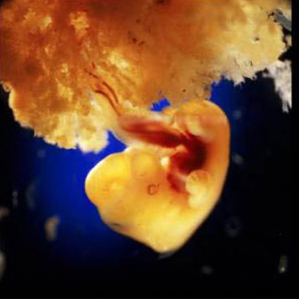 Quá trình phát triển của thai nhi 13