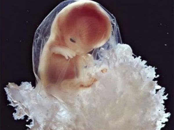 Quá trình phát triển của thai nhi 16