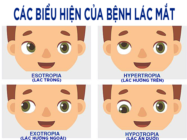 biểu hiện của bệnh lác mắt ở trẻ 
