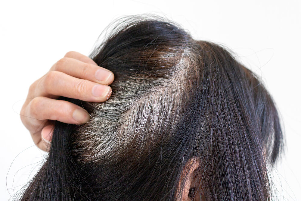 Những nguyên nhân khiến tóc bạc sớm và cách khắc phục