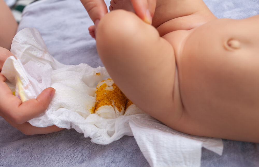 Vì sao trẻ sơ sinh đi ngoài ra chất nhầy?
