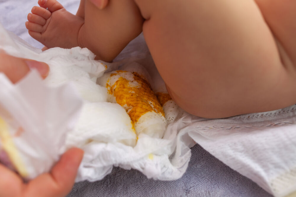 Trẻ sơ sinh đi ngoài có nhầy màu vàng: bình thường hay bất thường?