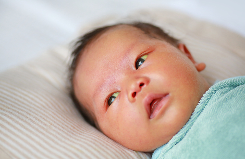 Bệnh vàng da ở trẻ sơ sinh là gì? Nguyên nhân, cách điều trị