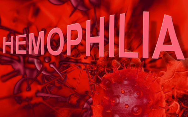 Bệnh Hemophilia, căn bệnh "hoàng gia đỏng đảnh" khó trị