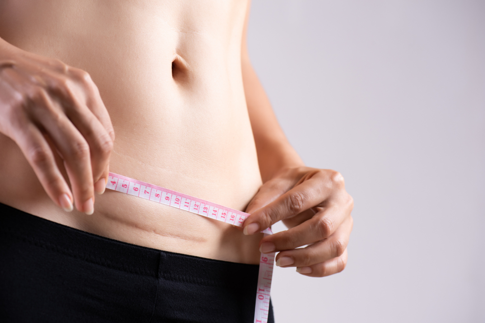 giảm cân sau khi sinh mổ