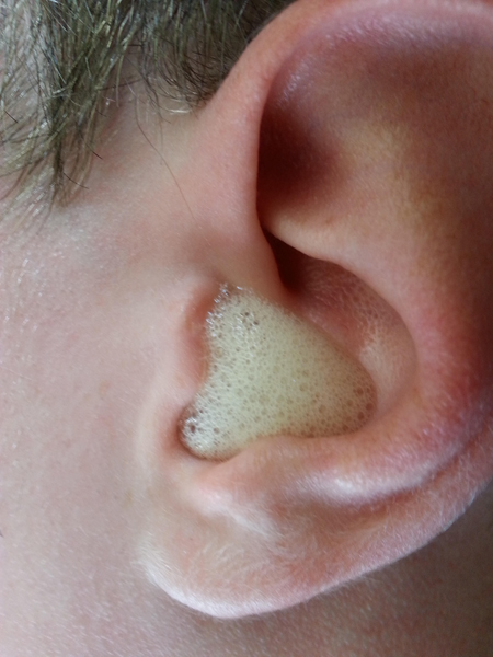 Công dụng của Ôxy già: rửa tai