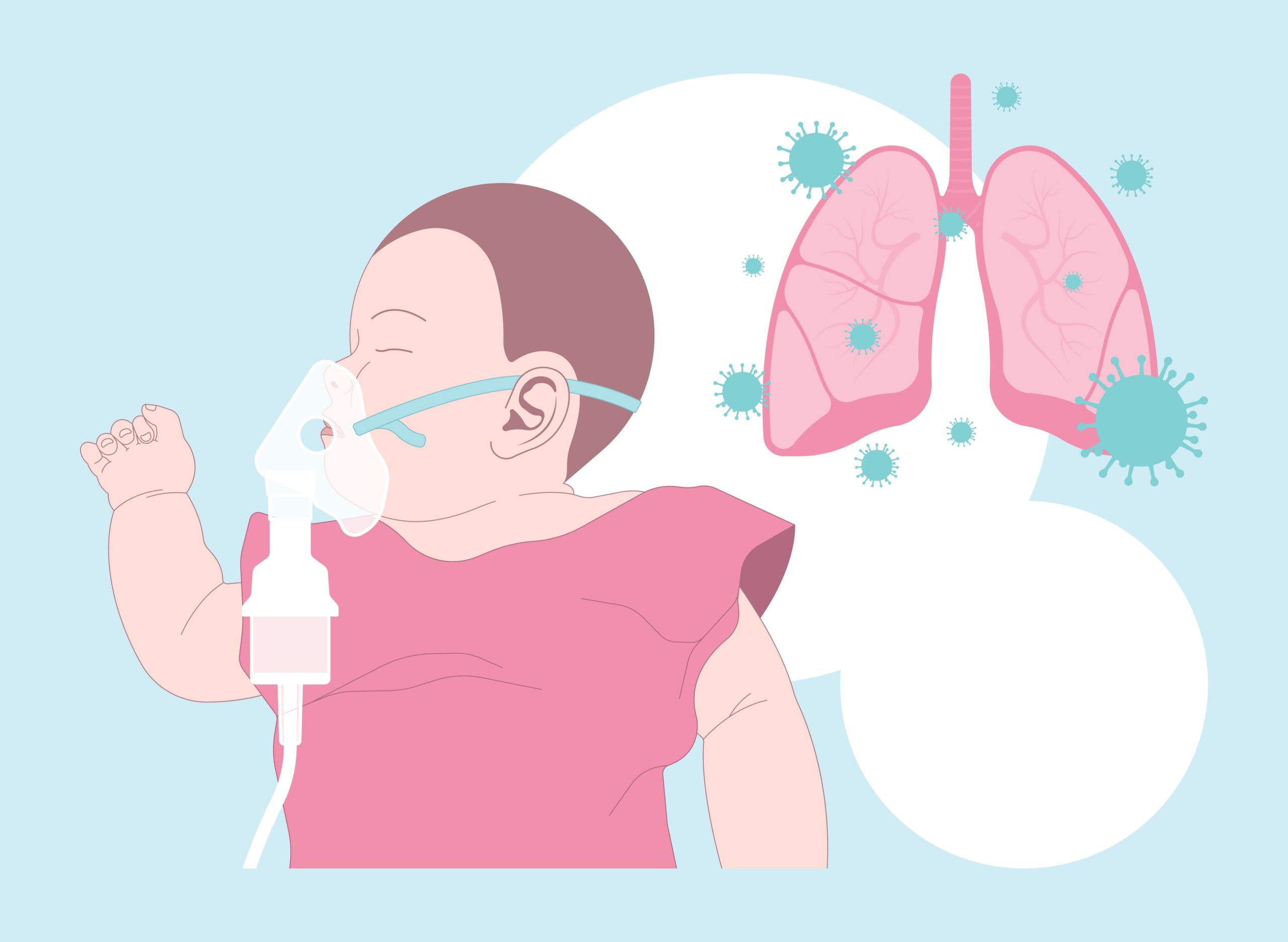 dấu hiệu viêm phổi ở trẻ sơ sinh