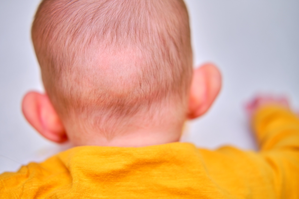Cách cải thiện và ngăn rụng tóc cho trẻ 3 tháng