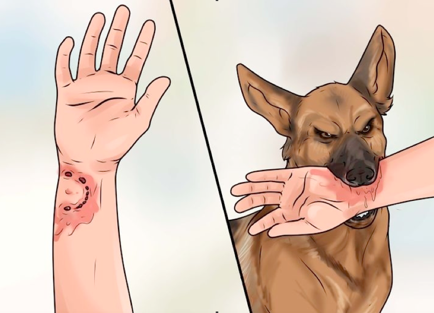 cách sơ cứu khi bị chó cắn: thoa thuốc sát trùng