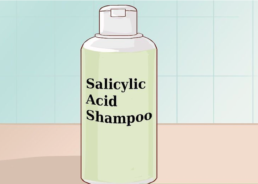 Dầu gội chứa axit salicylic có thể điều trị vảy nến da đầu 
