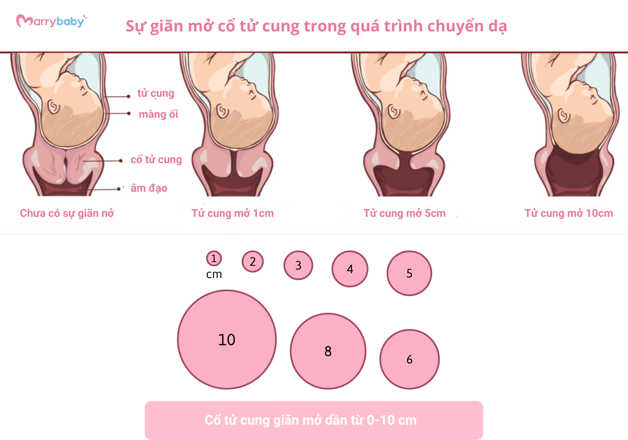 Hình ảnh cổ tử cung mở giúp bạn hiểu hơn vì sao cổ tử cung mở 1cm nhưng không đau bụng