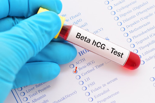 Xét nghiệm beta hCG âm tính nhưng vẫn có thai là thế nào?