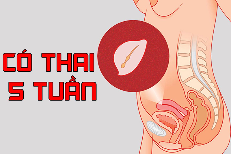 Thai 5 tuần có yolksac chưa có phôi có nguy hiểm không?