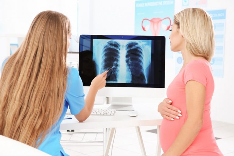 Giải đáp thắc mắc chụp X-quang khi mang thai 2 tuần có gây hại gì cho thai nhi?