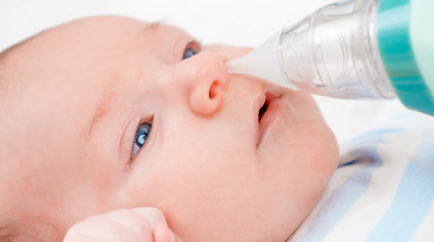 Nhỏ mũi cho trẻ bằng nước muối sinh lý và hút mũi