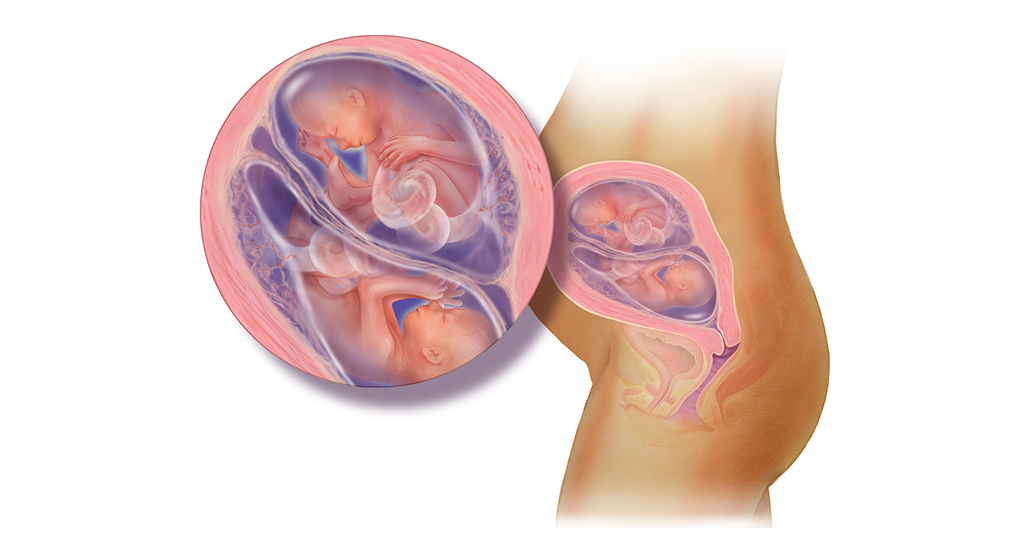 Mang bầu song thai (tuần 13-24) và sự phát triển của song thai