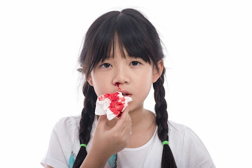 Trẻ bị chảy máu mũi một bên - Có sao không và cách xử lý như thế nào?