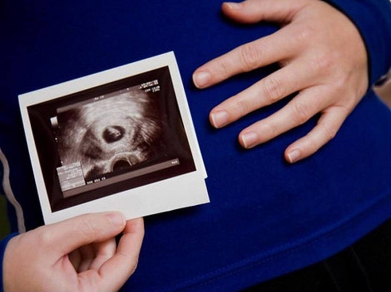 Siêu âm thai 6 tuần: Bé đang phát triển như thế nào?