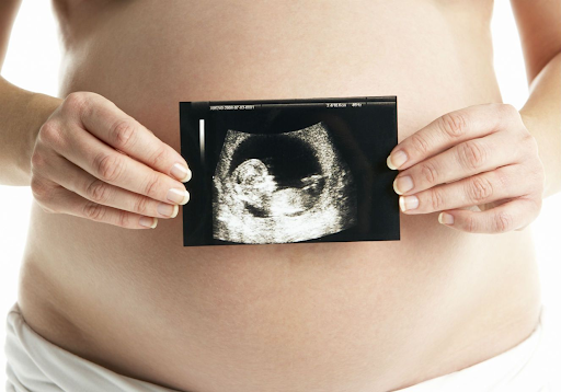 siêu âm thai 12 tuần tuổi 