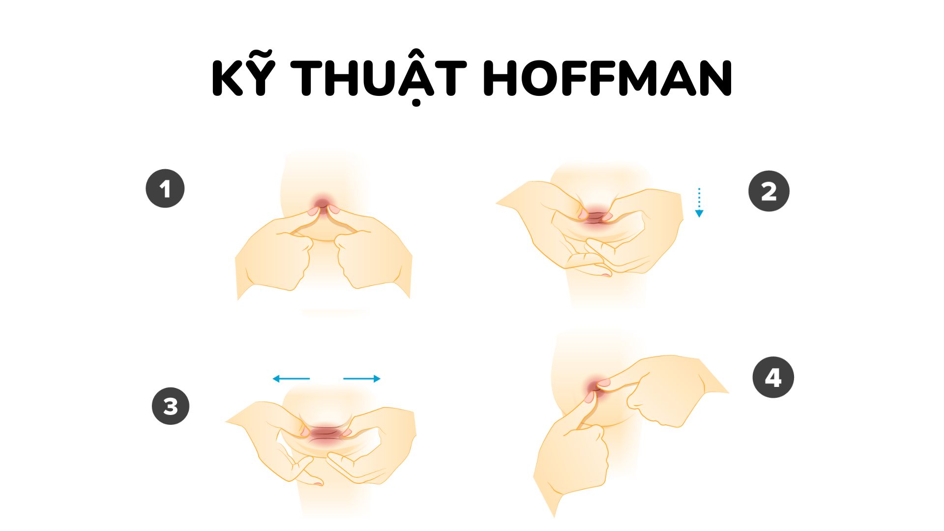 Kỹ thuật Hoffman