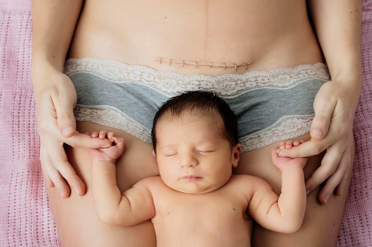 Sinh mổ 6 tháng có thai lại gây nguy hiểm cho thai nhi không?