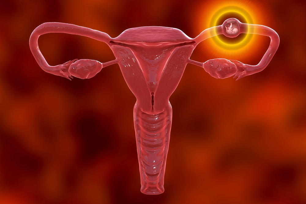 thai chưa vào tử cung siêu âm đầu dò có thấy không