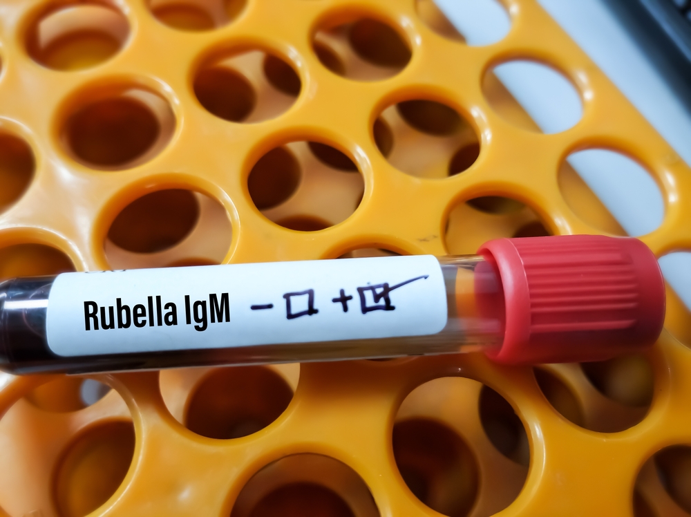 chích ngừa rubella có 2 tháng là có thai có được không