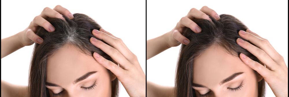 Bất ngờ 9 cách đơn giản ngăn ngừa và điều trị tóc bạc
