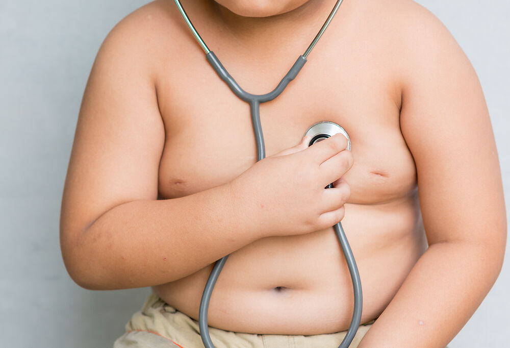 Những hậu quả do thừa cân béo phì ở trẻ em gây ra