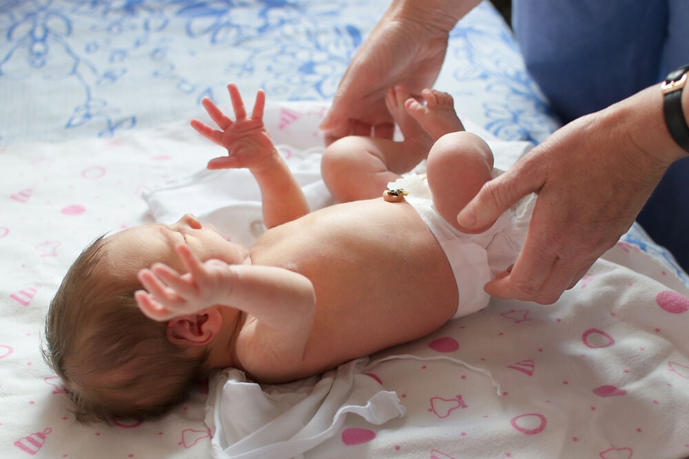 Cách đóng bỉm cho trẻ sơ sinh chưa rụng rốn an toàn và nhanh chóng