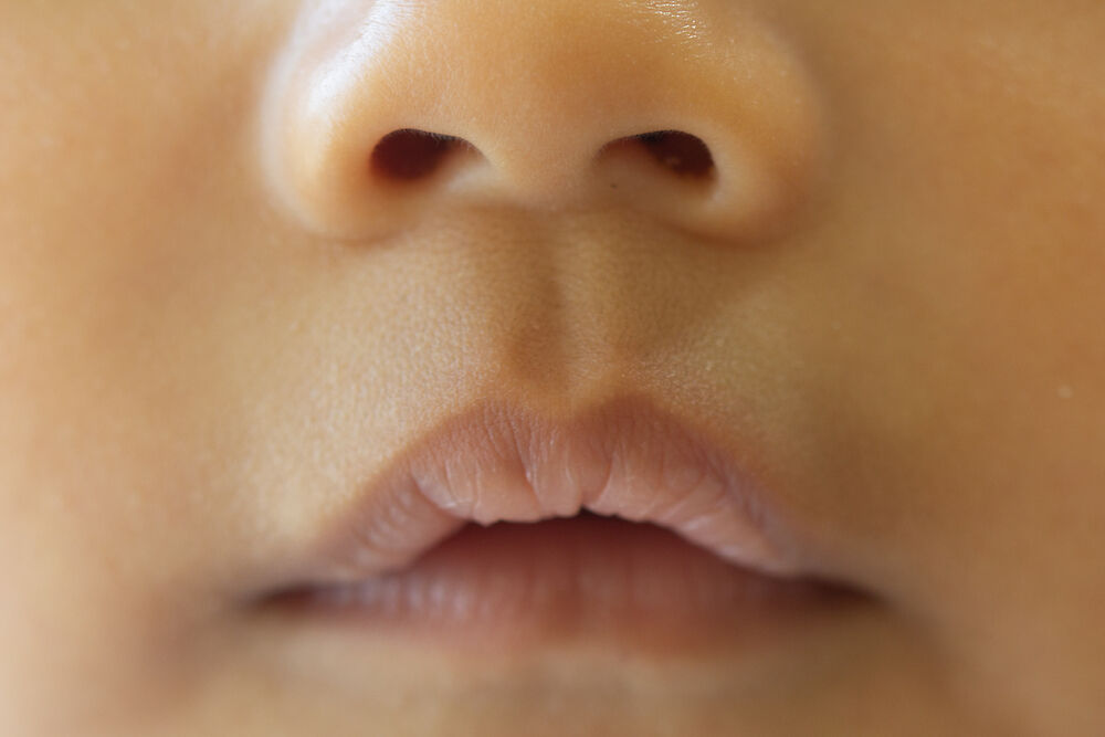 bé thâm môi có nguy hiểm?