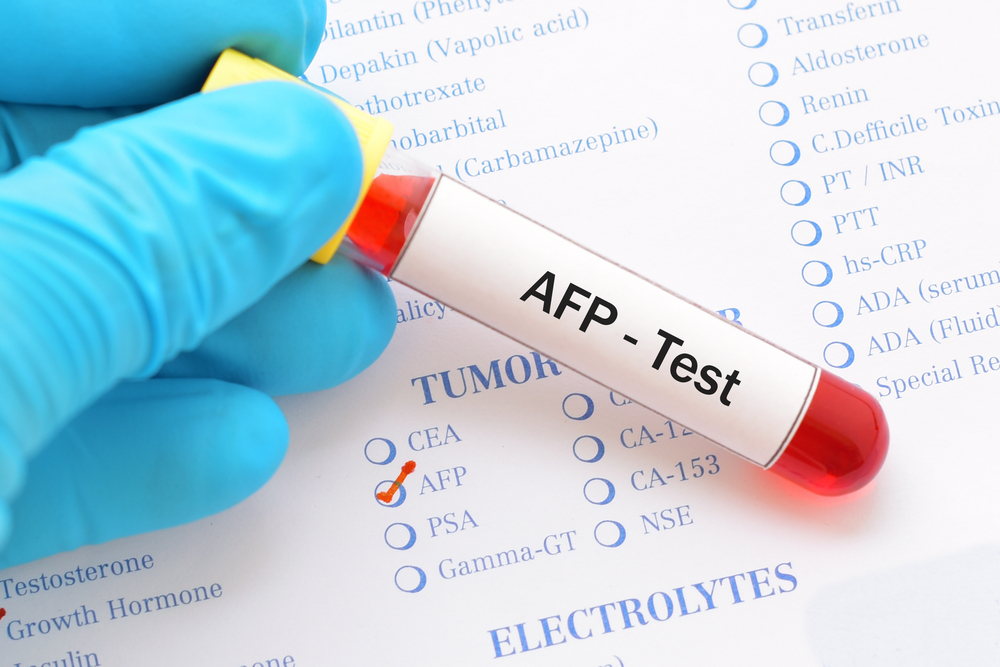 Xét nghiệm AFP cho biết gì về tình trạng thai nhi? Từ A đến Z thông tin cần thiết liên quan đến xét nghiệm AFP