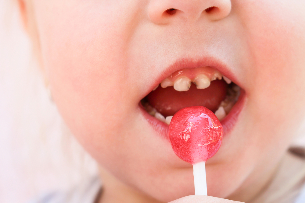 Vì sao trẻ nhỏ hay ăn kẹo rất dễ bị sâu răng?