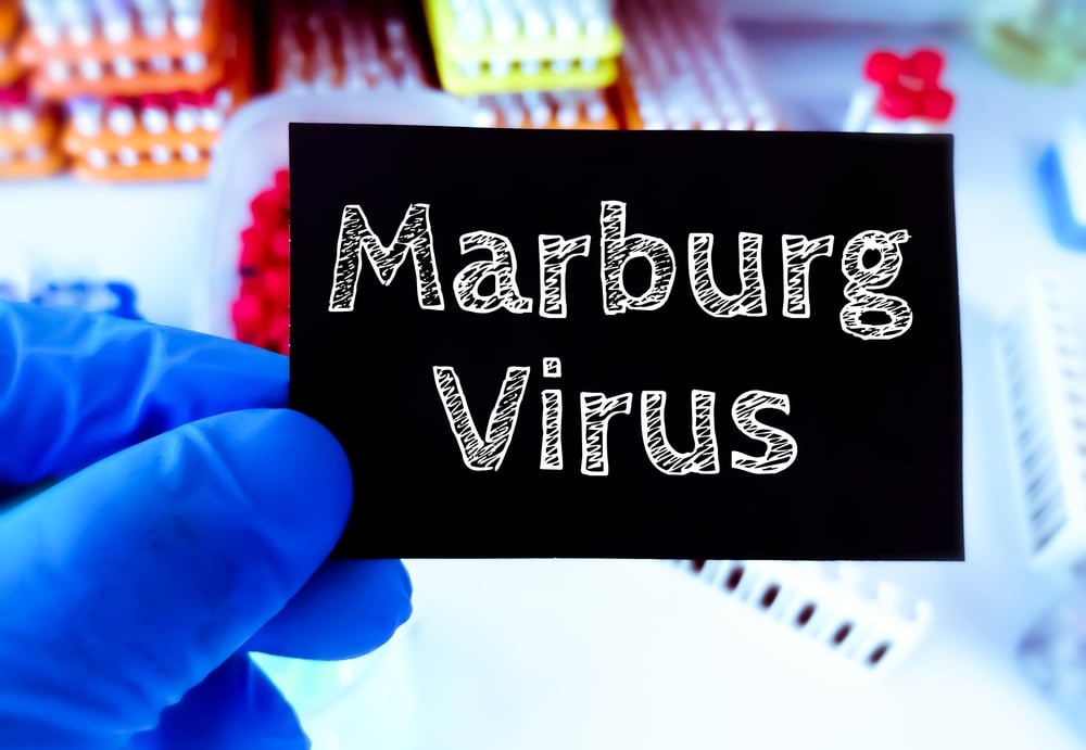 Virus Marburg là gì? Triệu chứng, điều trị và cách phòng ngừa