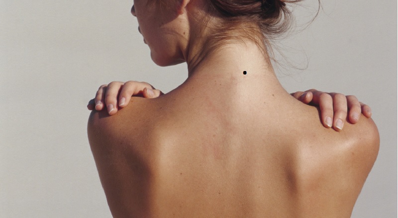 ý nghĩa nốt ruồi ở sau cổ giữa gáy