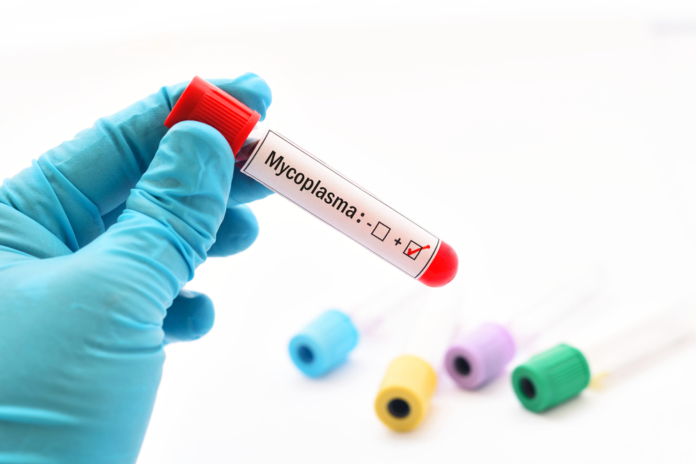 Vi khuẩn Mycoplasma là gì